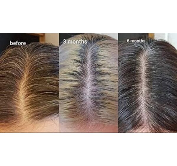 The Ordinary The Ordinary Multi-Peptide Serum for Hair Density 60ml- For All Hair Types - Image 8